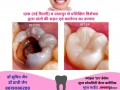 dentist-in-jabalpur-dr-sumit-jain-dental-clinic-jabalpur-smile-n-braces-dental-clinic-in-jabalpur-laser-and-orthodonitic-centre-in-jabalpur-small-1