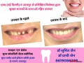 dentist-in-jabalpur-dr-sumit-jain-dental-clinic-jabalpur-smile-n-braces-dental-clinic-in-jabalpur-laser-and-orthodonitic-centre-in-jabalpur-small-2