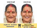 best-dentist-and-dental-surgeon-orthodontist-clinic-in-jabalpur-dr-sumit-jain-smile-n-braces-superspeciality-dental-clinic-best-dental-clinic-small-5